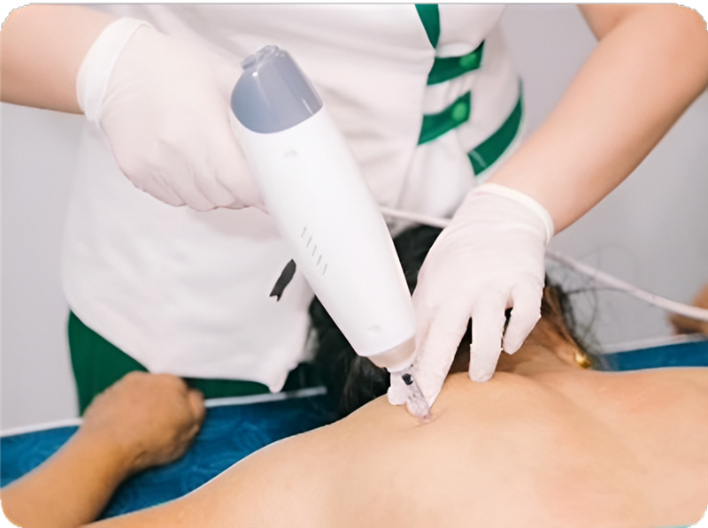 Máy bắn tinh chất nọc rắn